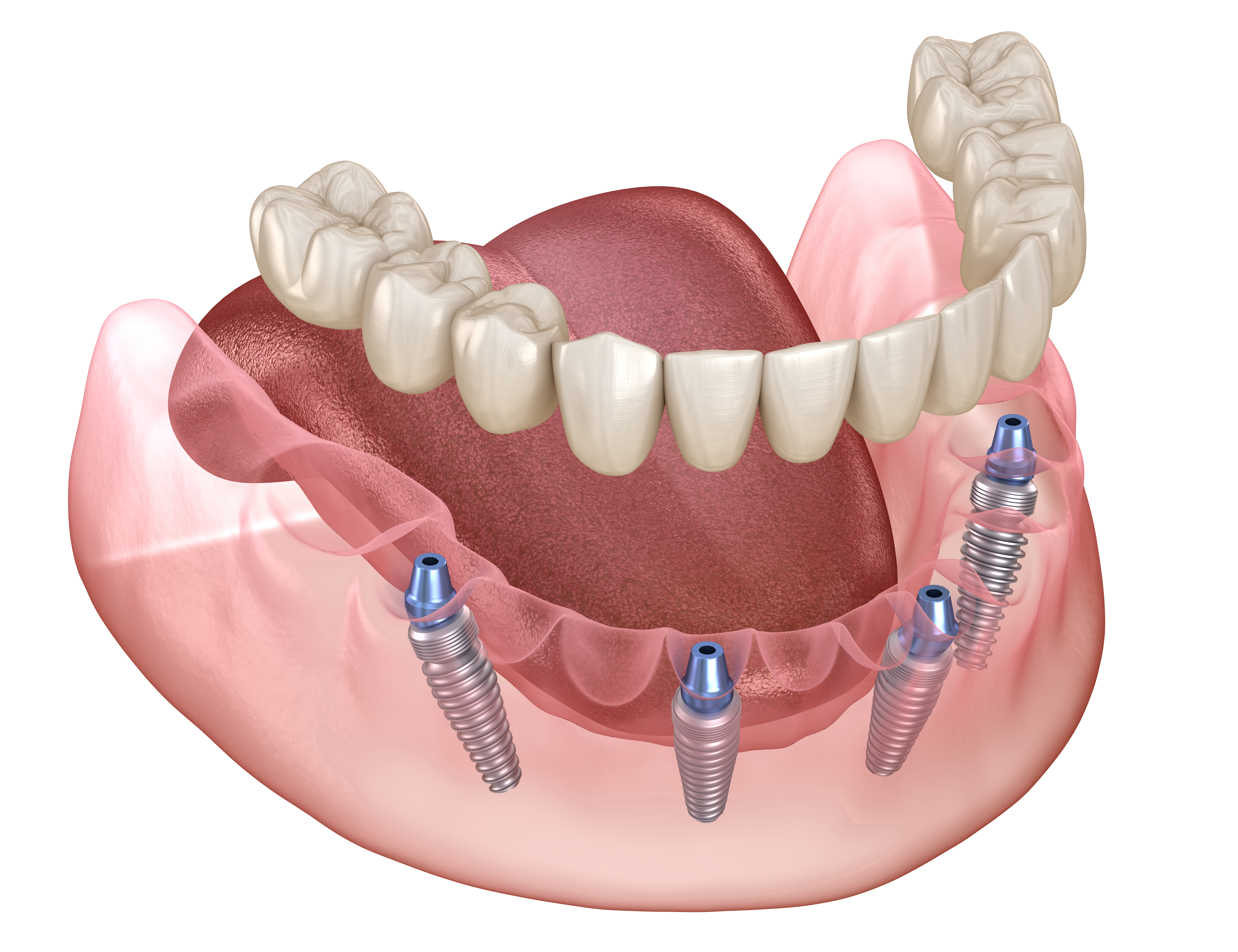 Quality Dental Treatments in El Dorado Hills